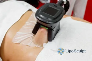 Cryolipolysis Helping You Getting that Perfect Summer Body 3 Cryolipolysis Camberley can give you the best summer body - contact us today!