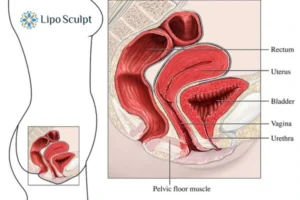 Treatment For A Leaky Bladder 2 How EM Chair treatment Camberley can help Leaky bladder issues. Read more now!